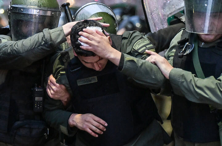 Uno de los gendarmes heridos en los incidentes.
Foto Federico Lopez Claro - FTP CLARIN IMG_4597.JPG Z RGonzalez gonzalez