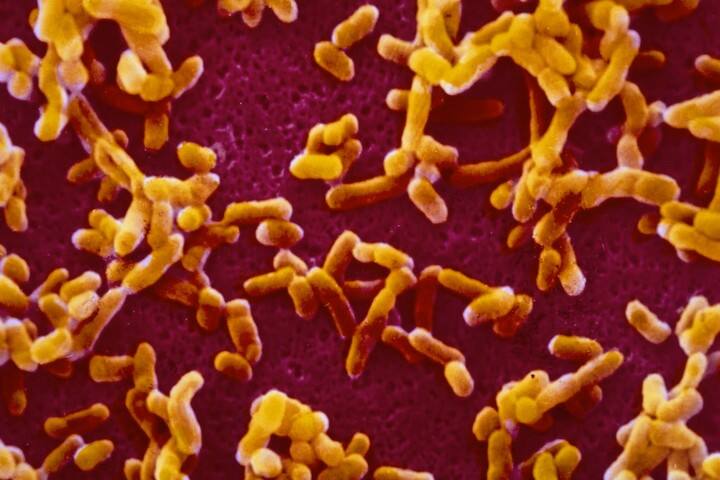 Micrografía electrónica de barrido coloreada de Yersinia pestis, la bacteria causante de la peste. Foto CNRI/Science Source